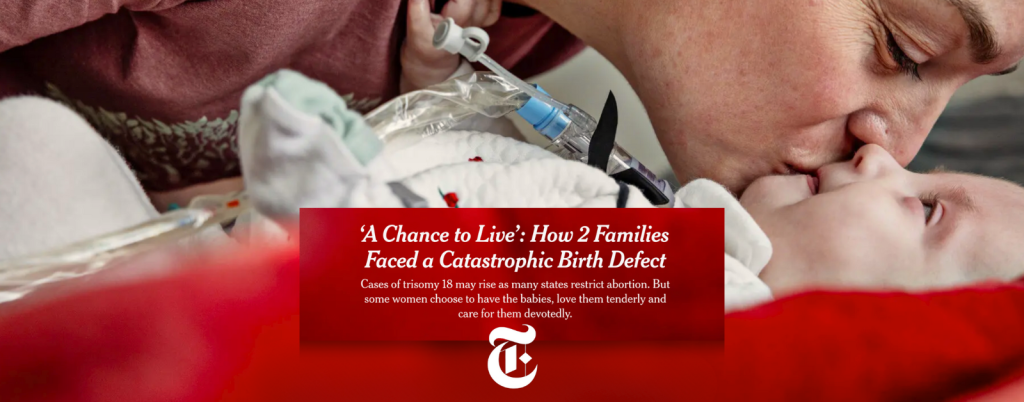 a screenshot of the NYT essay cover, which is a close-up view of Ashlee Wiseman, bending down to kiss her daughter, Lennie, who is lying on a red blanket. Below is text that says: “‘A Chance to Live’: How 2 Families Faced a Catastrophic Birth Defect. Cases of trisomy 18 may rise as many states restrict abortion. But some women choose to have the babies, love them tenderly and care for them devotedly.”