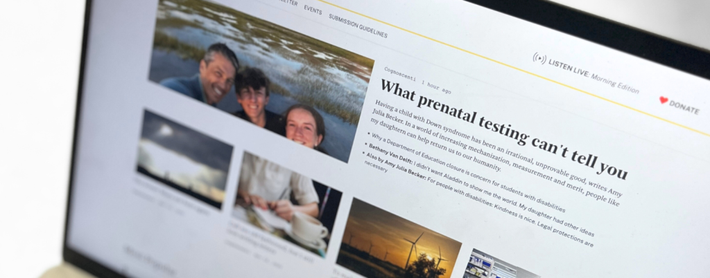 photo of a laptop screen with the homepage of Cognoscenti showing Amy Julia Becker's essay: What prenatal testing can't tell you